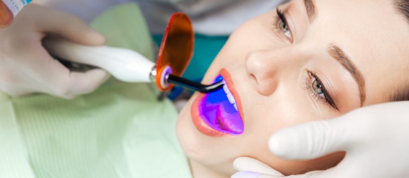 Root canal Therapy Brampton